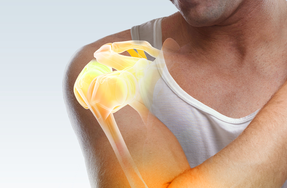 Illustration of the shoulder
